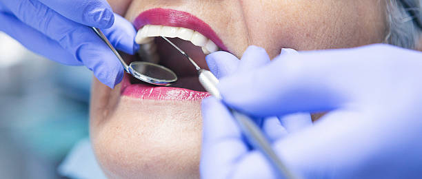 Best Broken or Cracked Tooth Emergency Dentist in Mayo, MD